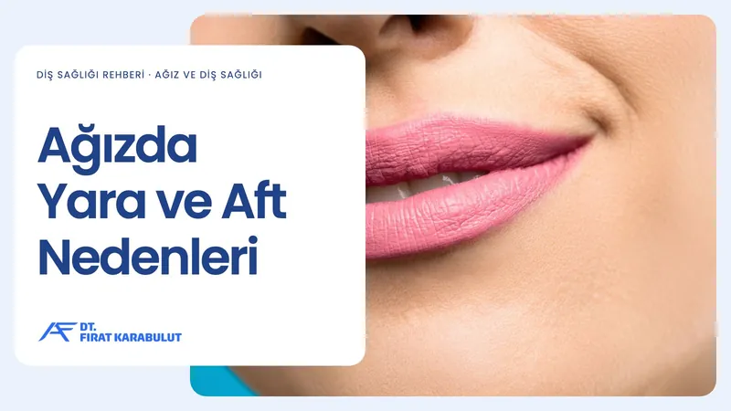 Ağızda Yara ve Aft Nedenleri
