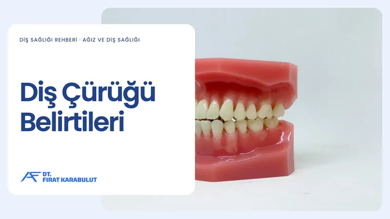 Diş Çürüğü Belirtileri