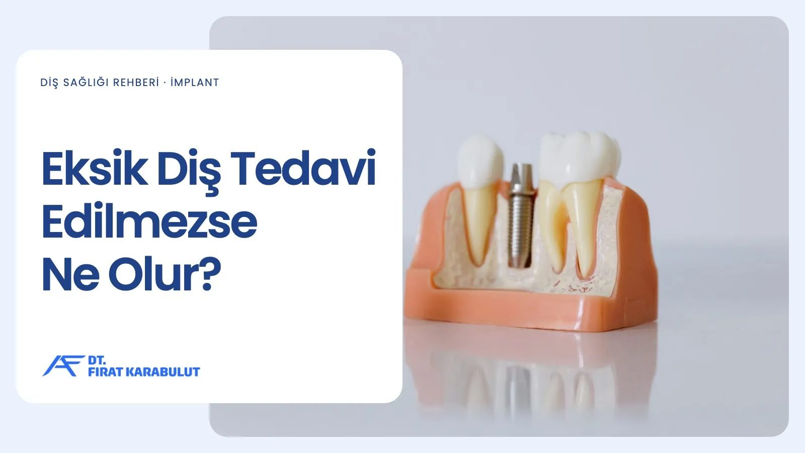 Eksik Diş Tedavi Edilmezse Ne Olur?
