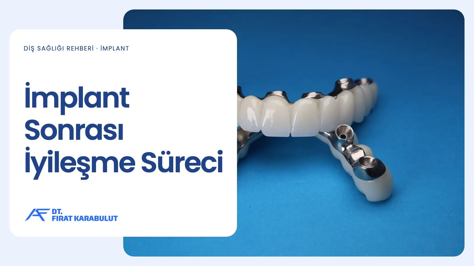 İmplant Sonrası İyileşme Süreci