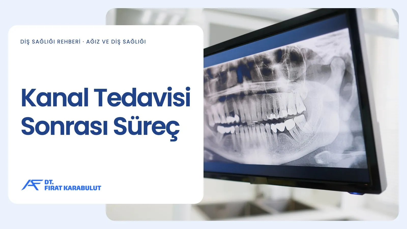Kanal Tedavisi Sonrası Süreç