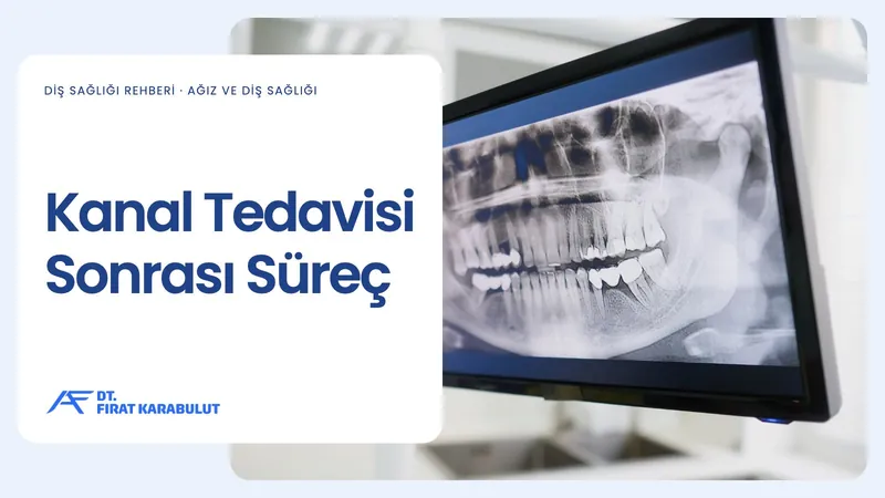 Kanal Tedavisi Sonrası Süreç