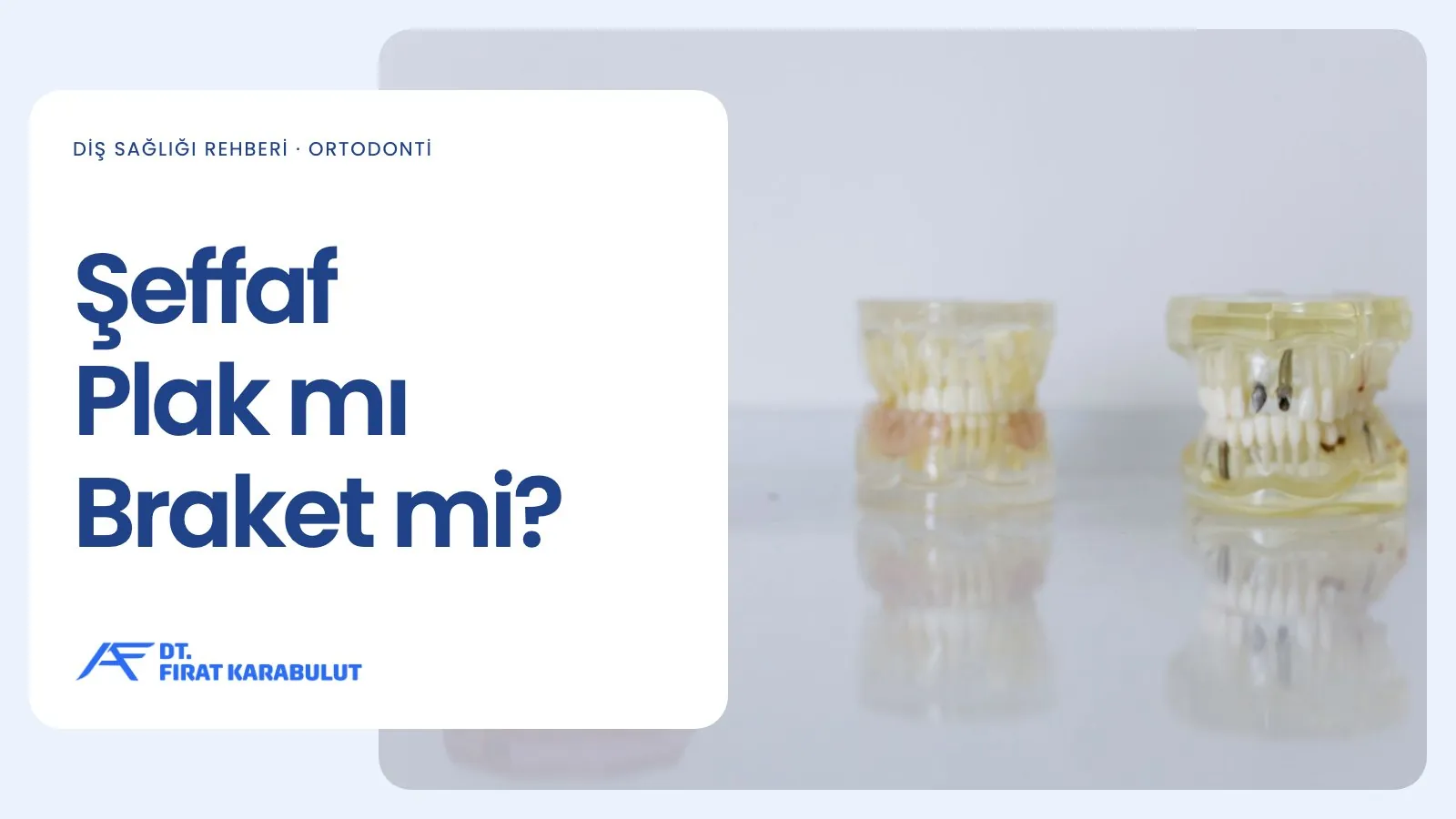 Şeffaf Plak mı Braket mi?