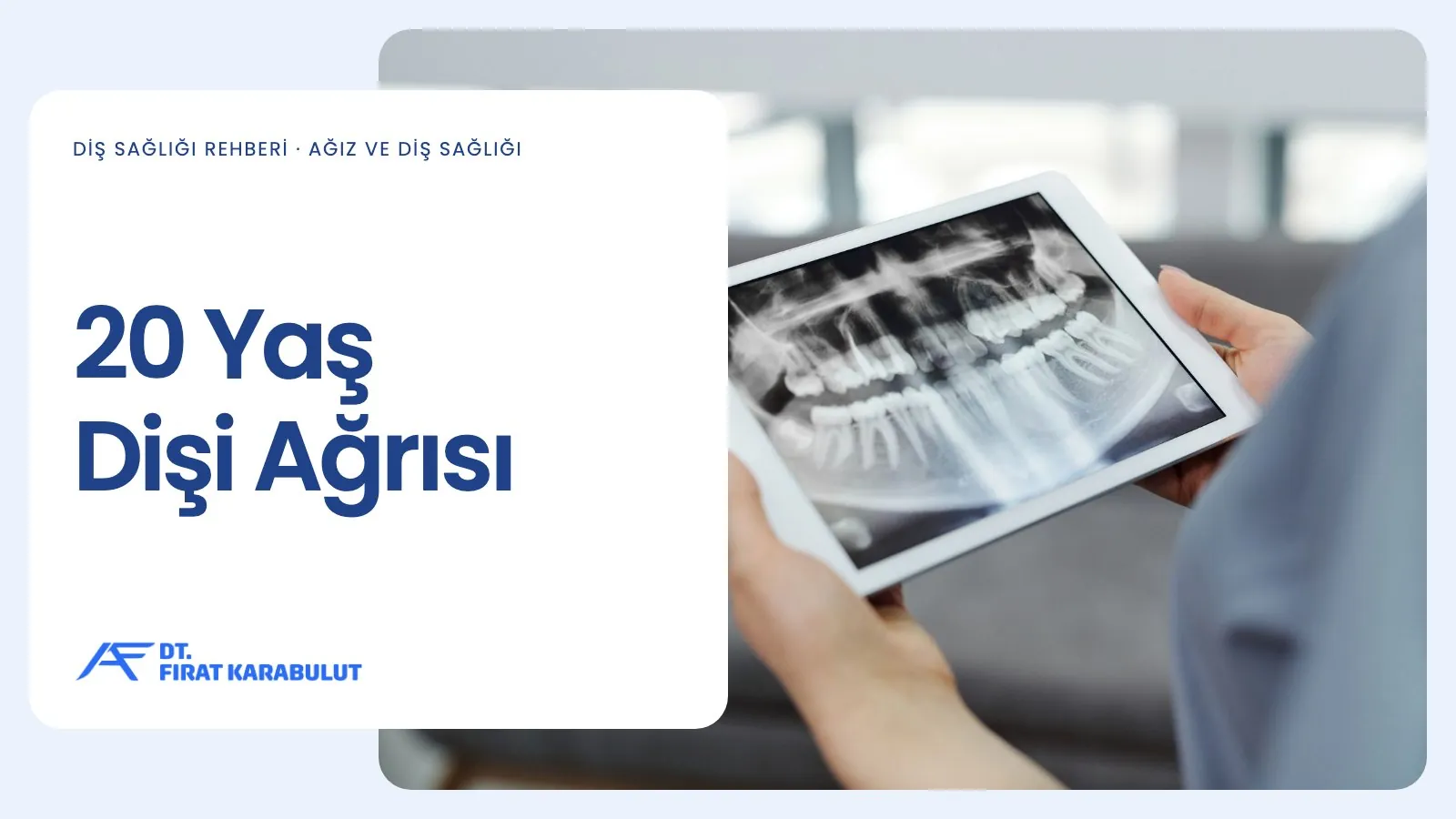 20 Yaş Dişi Ağrısı